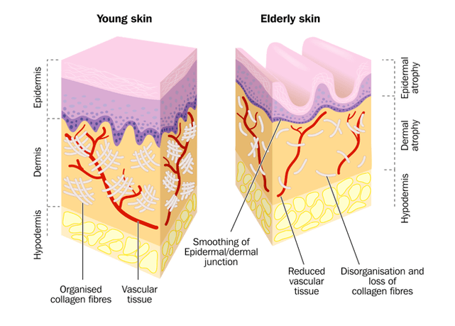 Îmbătrânirea pielii